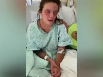 Una joven española pide ayuda desde EEUU tras quedarse ciega por un accidente con sosa caústica 