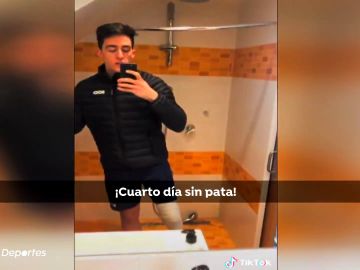 Alberto Ávila, el velocista paralímpico que es una estrella en Tik Tok: "Cuento que me comió una pierna un tiburón"