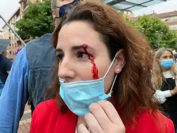 Diputada de Vox que ha recibido una pedrada Diputada de Vox que ha recibido una pedrada