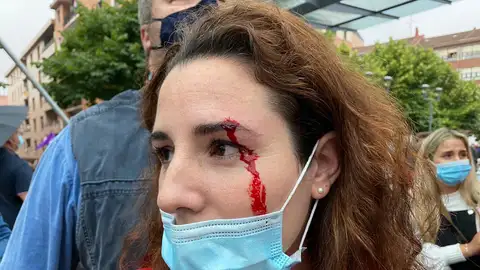 Diputada de Vox que ha recibido una pedrada Diputada de Vox que ha recibido una pedrada