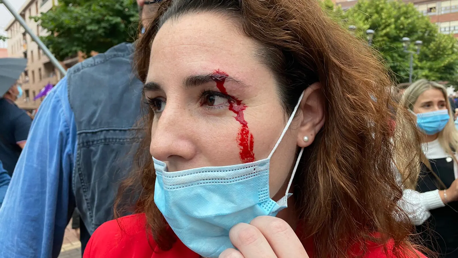 Diputada de Vox que ha recibido una pedrada