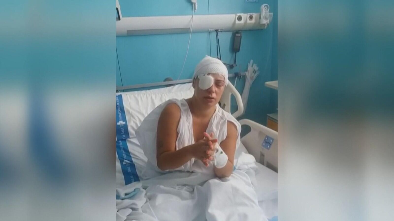 Habla la mujer quemada con ácido: 