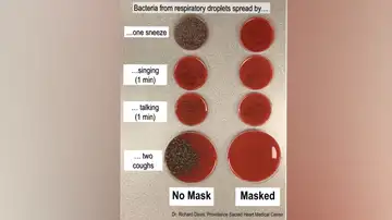 Estudio sobre los gérmenes que expulsamos al toser Estudio sobre los gérmenes que expulsamos al toser