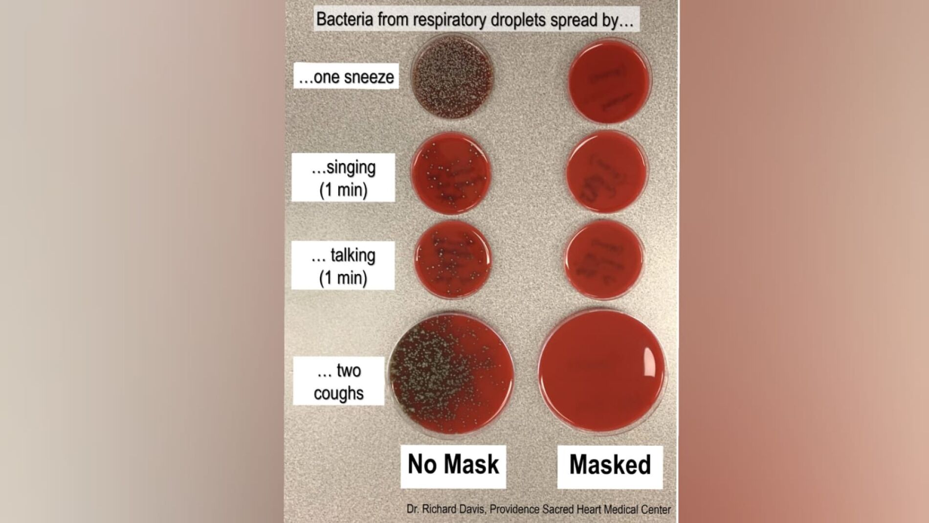 Estudio sobre los g&eacute;rmenes que expulsamos al toser