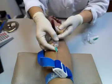 Un paciente de SIDA podría curarse solo con un tratamiento medicinal Un paciente de SIDA podría curarse solo con un tratamiento medicinal