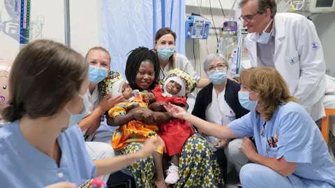Separan con éxito a dos siamesas en un hospital del Vaticano Siameses