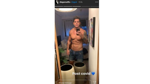 Diego Matamoros presume de su liposucción de abdomen 