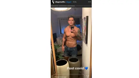 Diego Matamoros presume de su liposucción de abdomen Diego Matamoros presume de su liposucción de abdomen