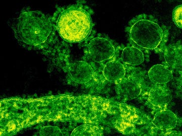 Nuevos estudios para tratar el coronavirus hasta que haya vacuna