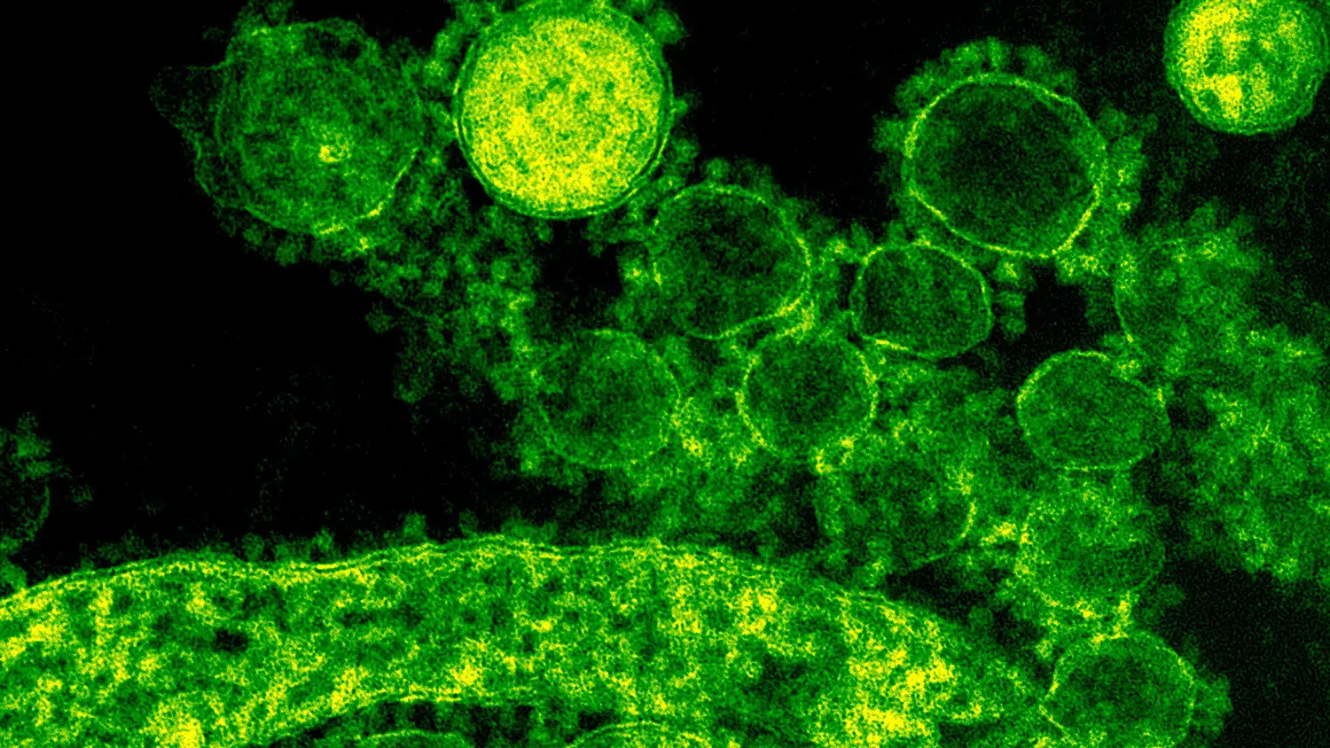 coronavirus