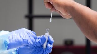 Test de coronavirus