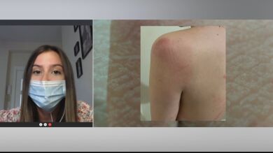 El duro relato de Isabella, asaltada y pateada en la cabeza por dos ladrones en Madrid: 