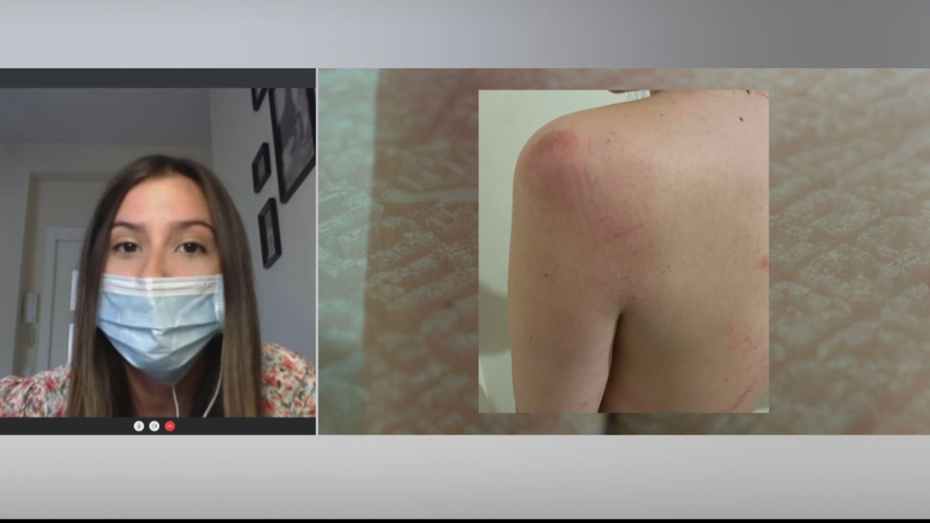 El duro relato de Isabella, asaltada y pateada en la cabeza por dos ladrones en Madrid: "He sentido m&aacute;s miedo que en Venezuela"