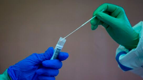 Pruebas PCR