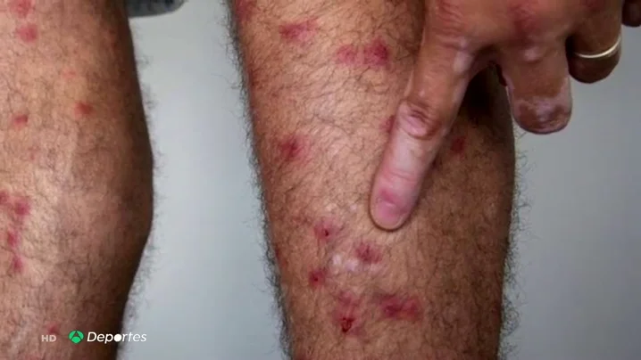 mosca