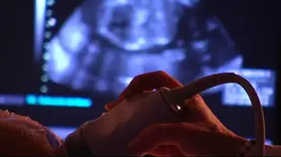 Una ecografía Edema de piel en fetos de mujeres embarazadas, el nuevo síntoma del coronavirus