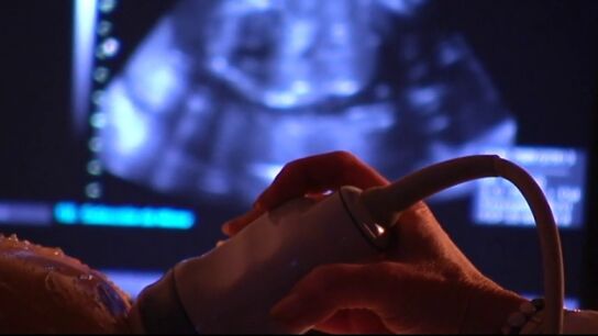 Edema de piel en fetos de mujeres embarazadas, el nuevo s&iacute;ntoma del coronavirus