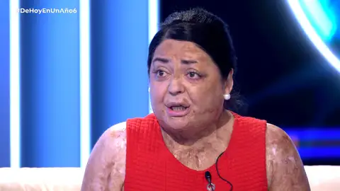 Mónica: ´´Tengo quemado el 80% de mi cuerpo” Mejores momentos | Programa 6