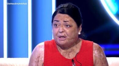 Mónica: ''Tengo quemado el 80% de mi cuerpo”