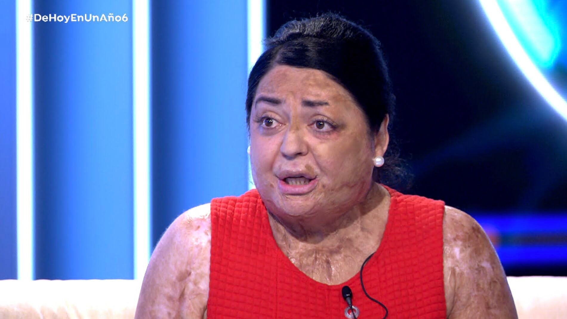 M&oacute;nica: &acute;&acute;Tengo quemado el 80% de mi cuerpo&rdquo;