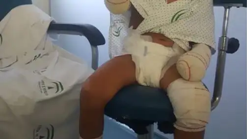 Carlota, una ni&ntilde;a de 4 a&ntilde;os de M&aacute;laga, pide ayuda para no perder sus extremidades por una isquemia