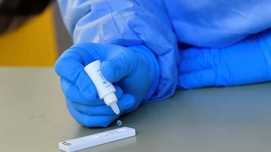 Pruebas en laboratorio