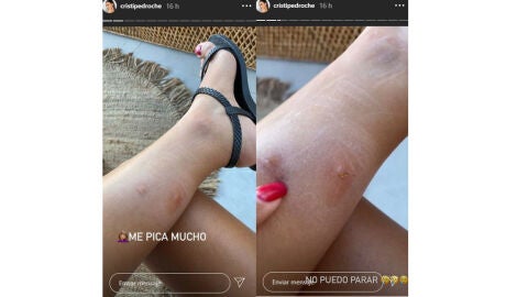 Cristina Pedroche