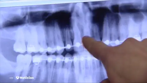 Dentix Dentix