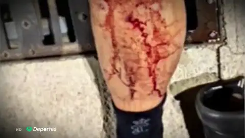 Investigan una brutal agresión de unos ultras a 6 guardia civiles tras un partido en Pego (Alicante) Investigan una brutal agresión de unos ultras a 6 guardia civiles tras un partido en Pego (Alicante)