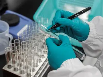 Noticias de la mañana (28-10-20) Científicos de Oxford alertan de la necesidad de un método común para evaluar la eficacia de las vacunas contra el coronavirus Noticias de la mañana (28-10-20) Científicos de Oxford alertan de la necesidad de un método común para evaluar la eficacia de las vacunas contra el coronavirus