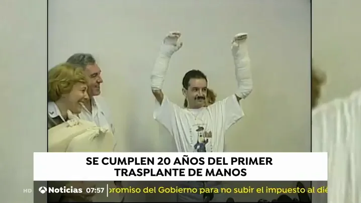 trasplante
