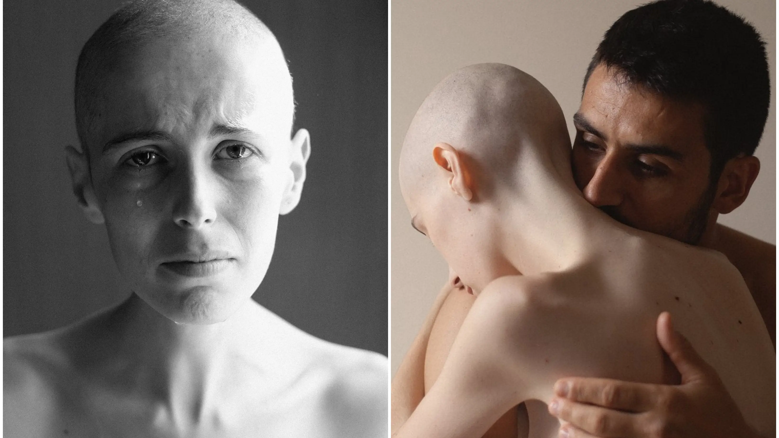 Las conmovedoras imágenes de la joven periodista Olatz Vázquez durante su lucha contra el cáncer Las conmovedoras imágenes de la joven periodista Olatz Vázquez durante su lucha contra el cáncer