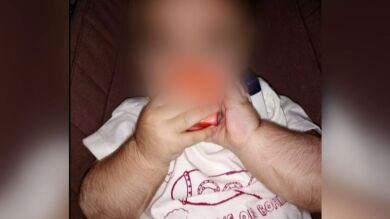 Los niños víctimas del falso omeprazol vuelven a sufrir efectos secundarios: 