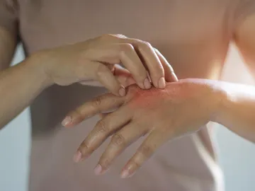 Picor en la mano Picor en la mano