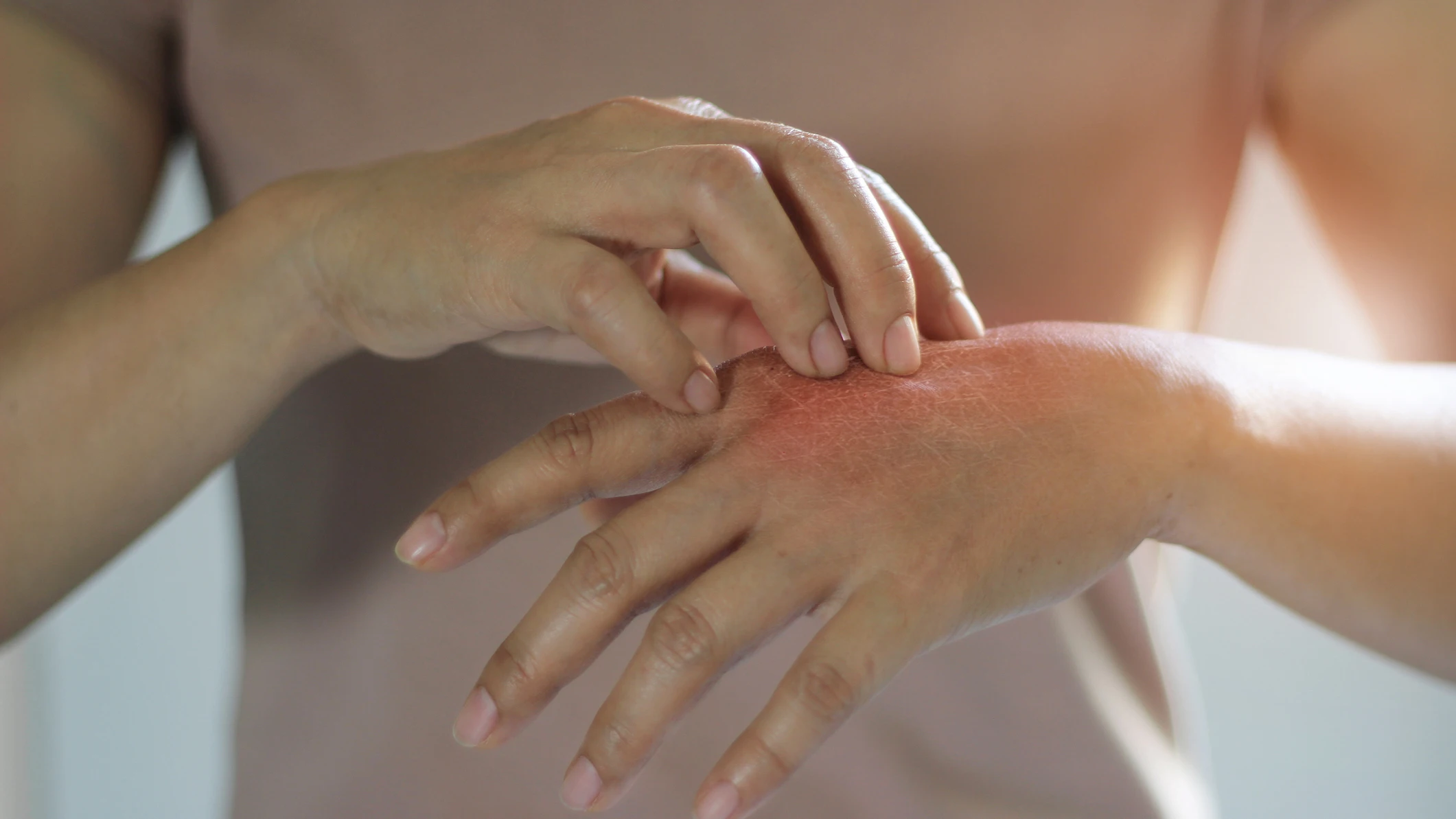 Picor en la mano Picor en la mano