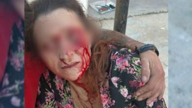 Unos okupas menores de edad apalean a una madre que defendía a su hijo en Alicante