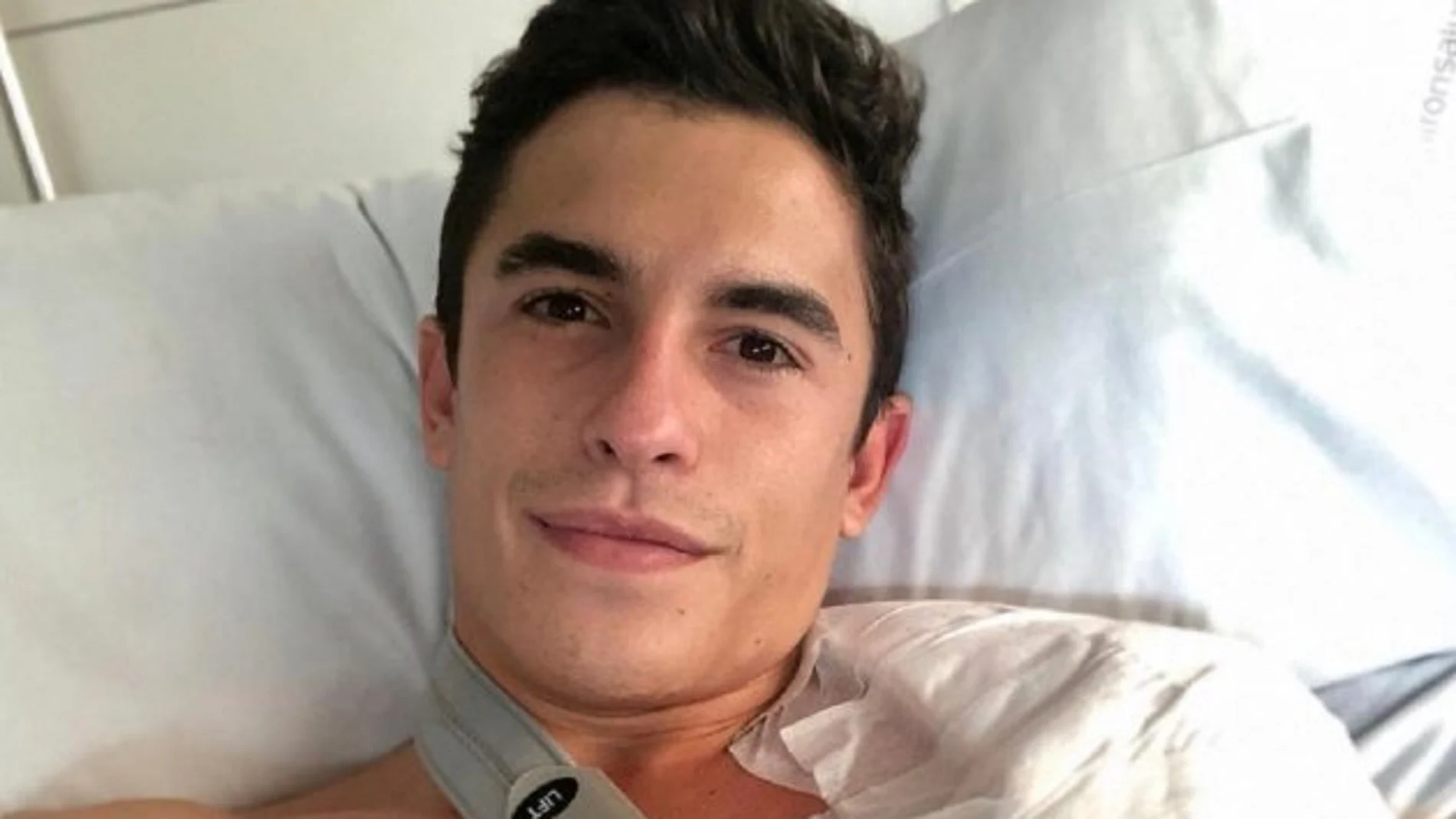Marc Márquez, operado por tercera vez de su brazo derecho en una intervención de 11 horas Marc Márquez, operado por tercera vez de su brazo derecho en una intervención de 11 horas