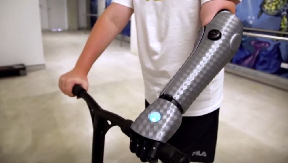 John, el niño de 11 años que estrena brazo biónico en Australia: "Me siento como Iron Man"