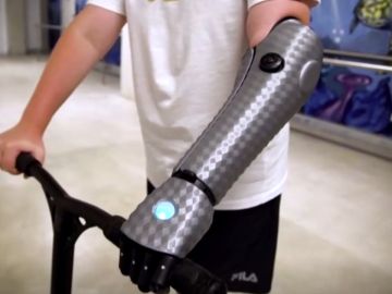 John, el niño de 11 años que estrena brazo biónico en Australia: "Me siento como Iron Man"