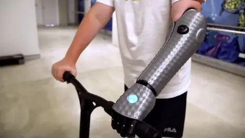 John, el niño de 11 años que estrena brazo biónico en Australia: "Me siento como Iron Man" John, el niño de 11 años que estrena brazo biónico en Australia: "Me siento como Iron Man"