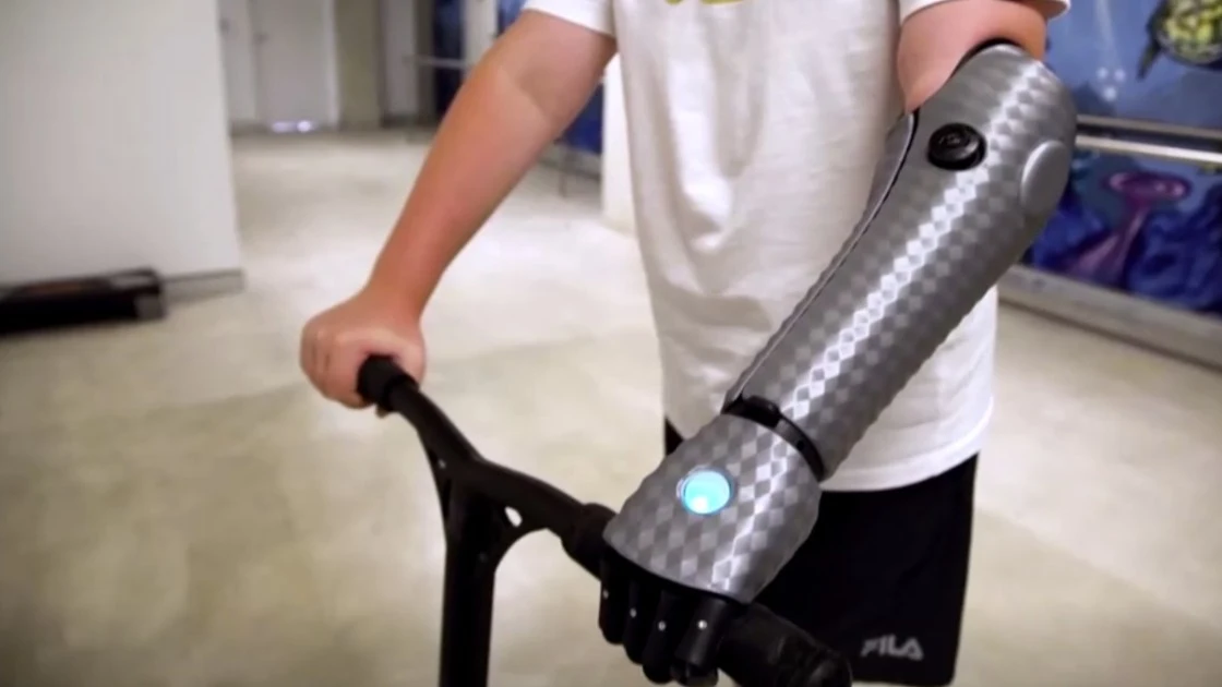 John, el niño de 11 años que estrena brazo biónico en Australia: "Me siento como Iron Man" John, el niño de 11 años que estrena brazo biónico en Australia: "Me siento como Iron Man"