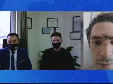 Falso testigo accidente tráfico. Falso testigo accidente tráfico.