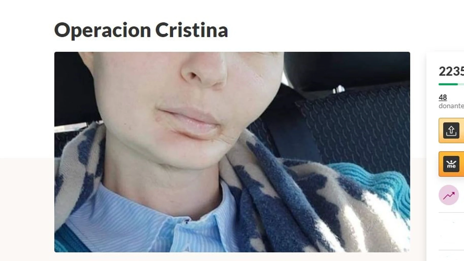Crowfunding para operación Cristina en GoFundMe Crowfunding para operación Cristina en GoFundMe