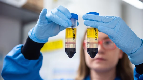 La Agencia Europea del Medicamento Vacuna de Oxford
