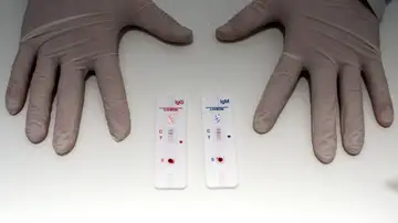 Así funcionan los test de antígenos que se venderán en farmacias Así funcionan los test de antígenos que se venderán en farmacias