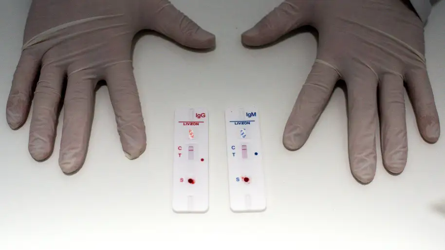 Así funcionan los test de antígenos que se venderán en farmacias Así funcionan los test de antígenos que se venderán en farmacias
