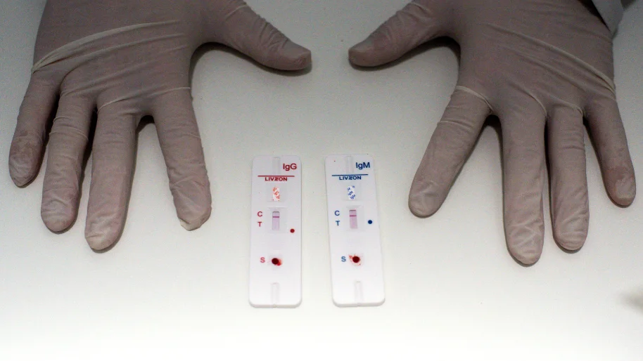 Así funcionan los test de antígenos que se venderán en farmacias Así funcionan los test de antígenos que se venderán en farmacias