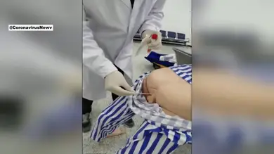 Médicos chinos muestran cómo realizar el test anal de coronavirus: 