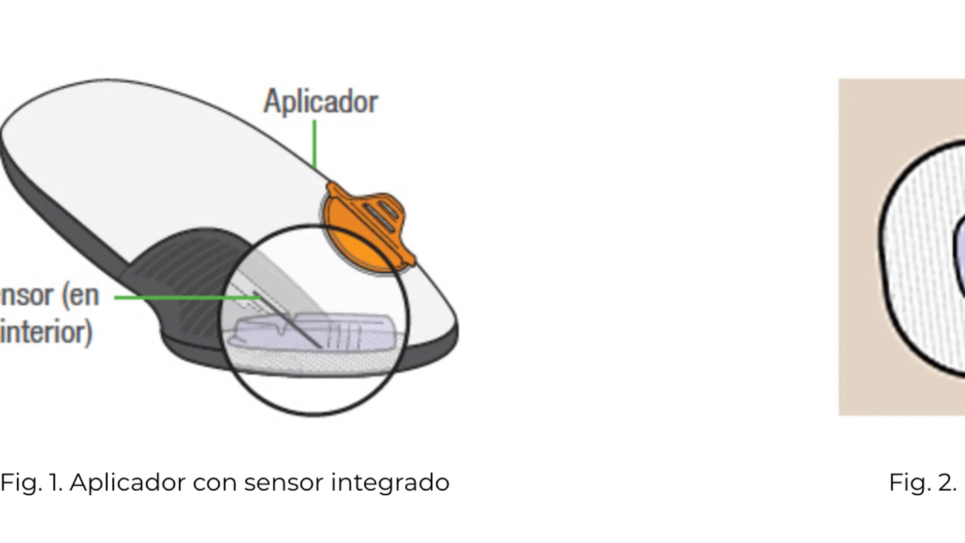 Sensores para diabéticos Sensores para diabéticos