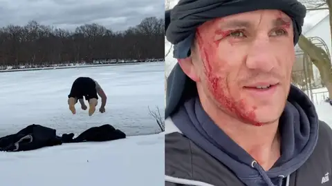 Merab Dvalishvili, luchador de UFC, se parte la cabeza al saltar a un lago helado Merab Dvalishvili, luchador de UFC, se parte la cabeza al saltar a un lago helado